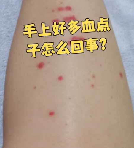 产后出现血点怎么办-第1张图片