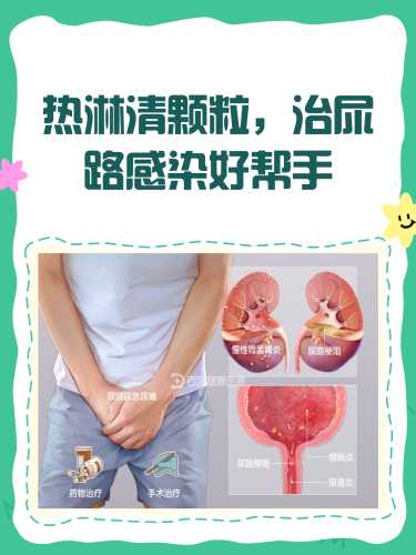 备孕期间能吃热淋清颗粒吗-第1张图片