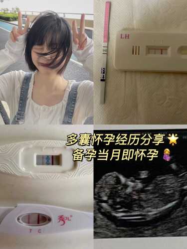 多囊卵巢如何备孕成功-第1张图片