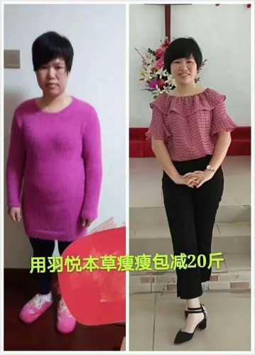 用瘦瘦包怀孕孩子能要吗-第1张图片