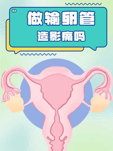 备孕前期需做造影吗-第1张图片
