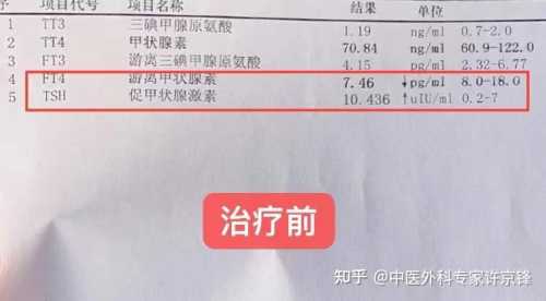 备孕未查甲状腺结节准吗-第1张图片