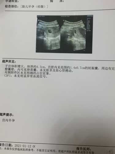 孕十一周孕反正常吗-第1张图片