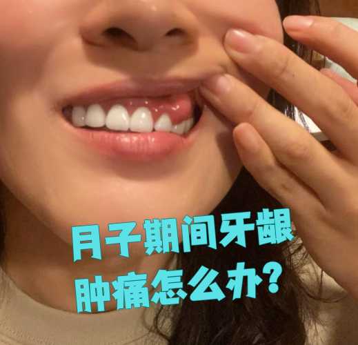月子里肿了是怎么回事-第1张图片