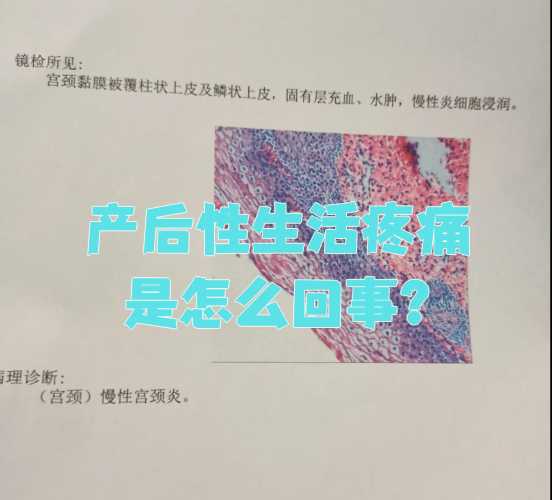 产后会阴疼是怎么回事-第1张图片