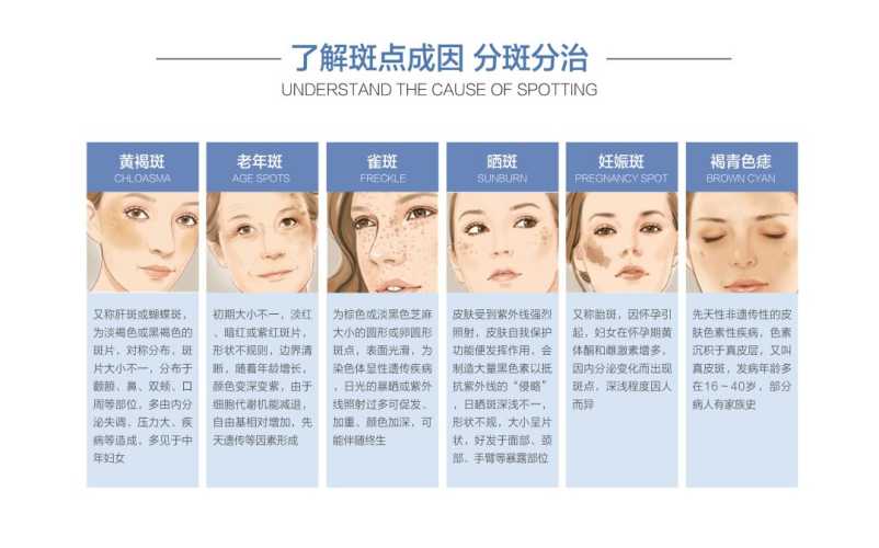 产后面部长斑该如何解决-第1张图片